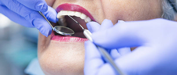 Best Emergency Tooth Extraction in Nisswa, MN